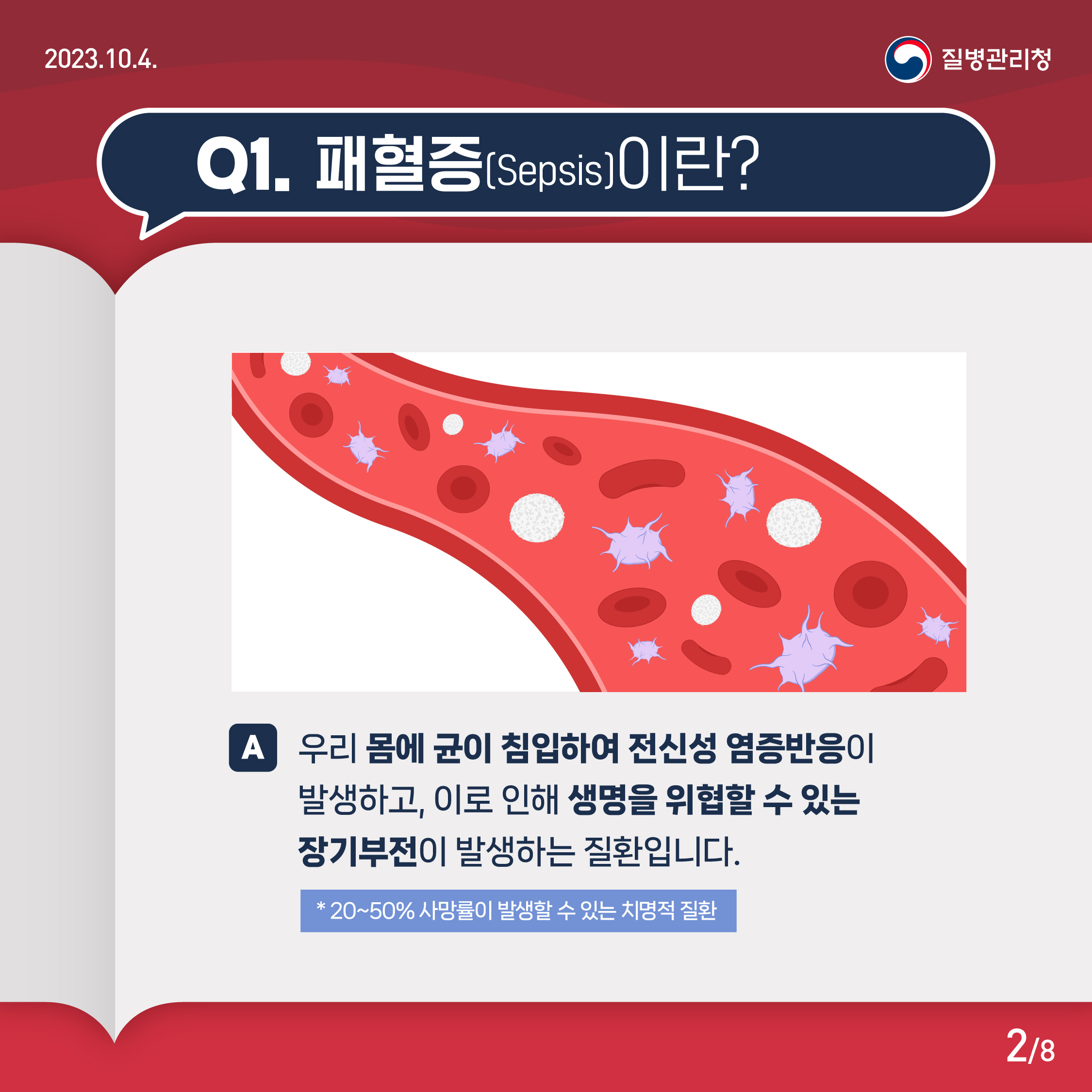 Q1. 패혈증(sepsis)이란? A. 우리 몸에 균이 침입하여 전신성 염증반응이 발생하고, 이로 인해 생명이 위협할 수 있는 장기부전이 발생하는 질환입니다. *20~50% 사망률이 발생할 수 있는 치명적 질환